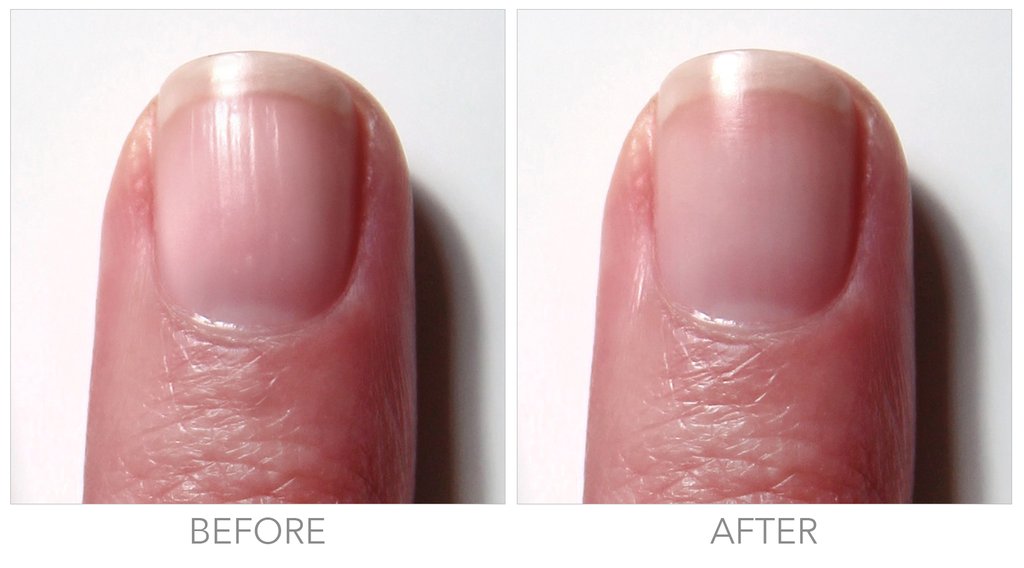 10 Things Your Nails Can Reveal About Your Health - The Singapore Women's  Weekly